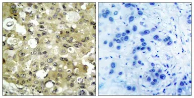 Anti-VEGF Receptor 2 antibody used in IHC (Paraffin sections) (IHC-P). GTX50432