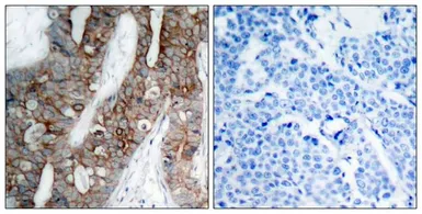 Anti-Integrin beta 3 antibody used in IHC (Paraffin sections) (IHC-P). GTX50435