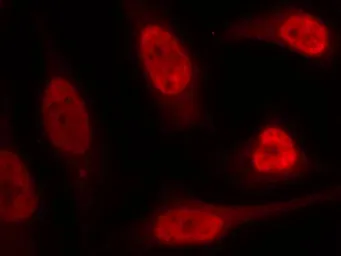 Anti-p53 antibody used in Immunocytochemistry/ Immunofluorescence (ICC/IF). GTX50438