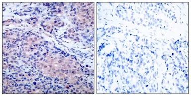Anti-IKB alpha antibody used in IHC (Paraffin sections) (IHC-P). GTX50468