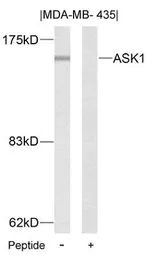 Anti-ASK1 antibody used in Western Blot (WB). GTX50471