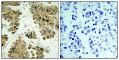 Anti-AKT2 antibody used in IHC (Paraffin sections) (IHC-P). GTX50494