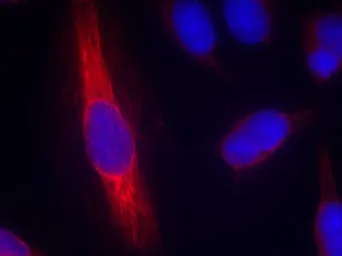 Anti-nNOS antibody used in Immunocytochemistry/ Immunofluorescence (ICC/IF). GTX50497