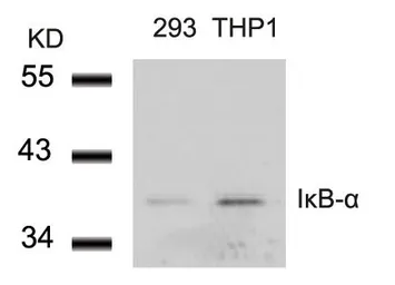 Anti-IKB alpha antibody used in Western Blot (WB). GTX50510