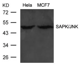 Anti-JNK antibody used in Western Blot (WB). GTX50564