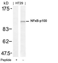 Anti-NFkB p100 antibody used in Western Blot (WB). GTX50610