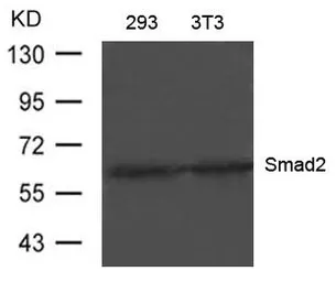 Anti-SMAD2 antibody used in Western Blot (WB). GTX50627