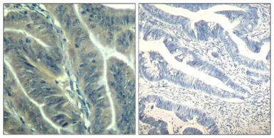 Anti-CDK6 antibody used in IHC (Paraffin sections) (IHC-P). GTX50665