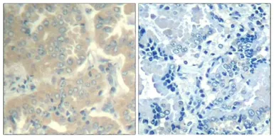 Anti-FAK antibody used in IHC (Paraffin sections) (IHC-P). GTX50666