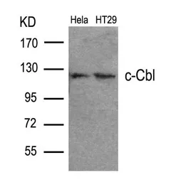 Anti-CBL antibody used in Western Blot (WB). GTX50669
