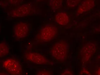 Anti-PKC beta 2 (phospho Thr641) antibody used in Immunocytochemistry/ Immunofluorescence (ICC/IF). GTX50682