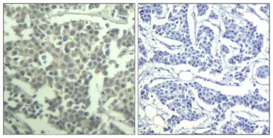 Anti-c-kit (phospho Tyr936) antibody used in IHC (Paraffin sections) (IHC-P). GTX50690