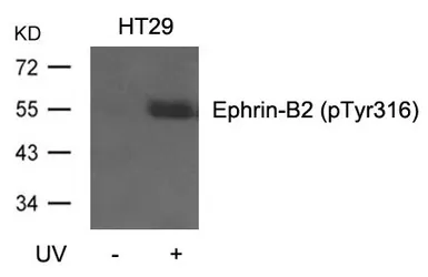 Anti-Ephrin B2 (phospho Tyr316) antibody used in Western Blot (WB). GTX50699
