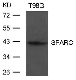 Anti-SPARC antibody used in Western Blot (WB). GTX50807