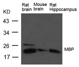Anti-Myelin basic protein antibody used in Western Blot (WB). GTX50815