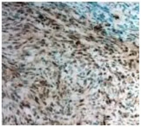 Anti-Twist1 antibody used in IHC (Paraffin sections) (IHC-P). GTX50821