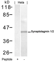 Anti-Synaptotagmin 1/2 antibody used in Western Blot (WB). GTX50862