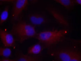 Anti-PAK1 ( phospho Thr423 ) / PAK2 ( phospho Thr402 ) / PAK3 ( phospho Thr436 ) antibody used in Immunocytochemistry/ Immunofluorescence (ICC/IF). GTX50867