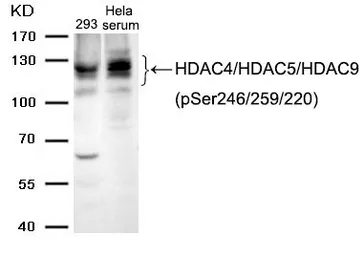 Anti-HDAC4 (phospho Ser246) + HDAC5 (phospho Ser259) + HDAC9 (phospho Ser220) antibody used in Western Blot (WB). GTX50871