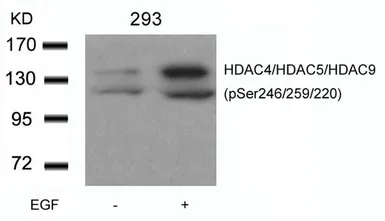 Anti-HDAC4 (phospho Ser246) + HDAC5 (phospho Ser259) + HDAC9 (phospho Ser220) antibody used in Western Blot (WB). GTX50871