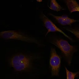 Anti-Cofilin1/Cofilin2 antibody used in Immunocytochemistry/ Immunofluorescence (ICC/IF). GTX50872