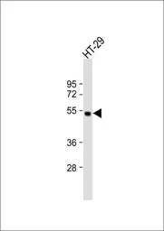 Anti-Hepatic lipase antibody used in Western Blot (WB). GTX50912