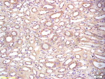 Anti-BAMBI antibody used in IHC (Paraffin sections) (IHC-P). GTX51308