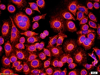 Anti-GM-CSF Receptor alpha antibody used in Immunocytochemistry/ Immunofluorescence (ICC/IF). GTX51383