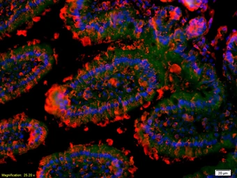 Anti-GM-CSF Receptor alpha antibody used in IHC (Paraffin sections) (IHC-P). GTX51383