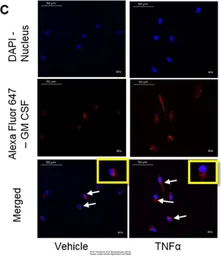 Anti-GM-CSF Receptor alpha antibody used in Immunocytochemistry/ Immunofluorescence (ICC/IF). GTX51383