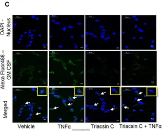 Anti-GM-CSF Receptor alpha antibody used in Immunocytochemistry/ Immunofluorescence (ICC/IF). GTX51383