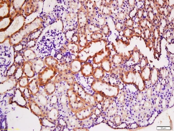 Anti-TACI antibody used in IHC (Paraffin sections) (IHC-P). GTX51554
