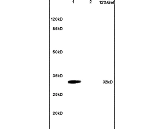 Anti-TACI antibody used in Western Blot (WB). GTX51554