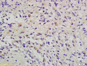 Anti-RAB14 antibody used in IHC (Paraffin sections) (IHC-P). GTX51556