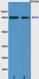 Anti-ARHGAP24 antibody used in Western Blot (WB). GTX51654
