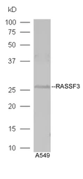 Anti-RASSF3 antibody used in Western Blot (WB). GTX51688