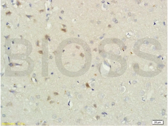 Anti-RNF122 antibody used in IHC (Paraffin sections) (IHC-P). GTX51802