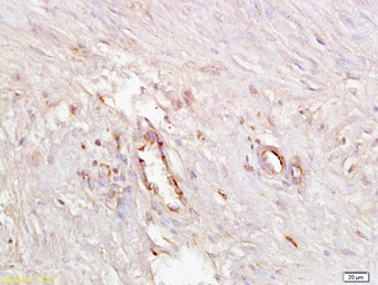 Anti-ICAM4 antibody used in IHC (Paraffin sections) (IHC-P). GTX51807