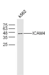 Anti-ICAM4 antibody used in Western Blot (WB). GTX51807