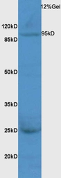 Anti-TTK antibody used in Western Blot (WB). GTX51836