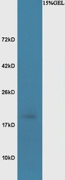 Anti-BASP1 antibody used in Western Blot (WB). GTX52007