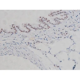 Anti-IKK alpha (phospho Ser180) + IKK beta (phospho Ser181) antibody used in IHC (Paraffin sections) (IHC-P). GTX52309