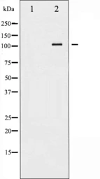 Anti-Sodium/Potassium ATPase alpha 1 (phospho Ser23) antibody used in Western Blot (WB). GTX52314