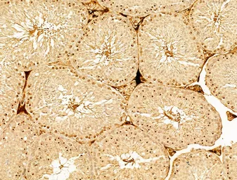 Anti-AMPK alpha 1 (phospho Thr183) + AMPK alpha 2 (phospho Thr172) antibody used in IHC (Paraffin sections) (IHC-P). GTX52341