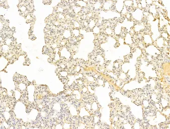 Anti-AMPK alpha 1 (phospho Thr183) + AMPK alpha 2 (phospho Thr172) antibody used in IHC (Paraffin sections) (IHC-P). GTX52341