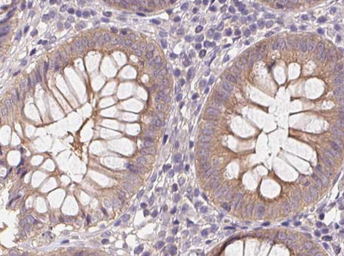 Anti-AMPK alpha 1 (phospho Thr183) + AMPK alpha 2 (phospho Thr172) antibody used in IHC (Paraffin sections) (IHC-P). GTX52341