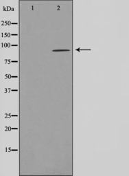 Anti-AHR antibody used in Western Blot (WB). GTX52358
