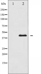 Anti-MEK1 + MEK2 antibody used in Western Blot (WB). GTX52369