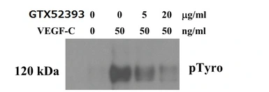 Anti-VEGFC antibody used in Neutralizing/Blocking/Inhibition (Neutralizing /Inhibition). GTX52393