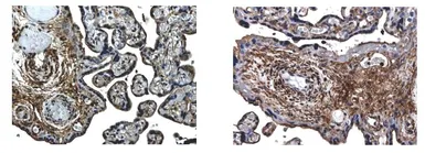 Anti-VEGF165b antibody [7F17] used in IHC (Paraffin sections) (IHC-P). GTX52502